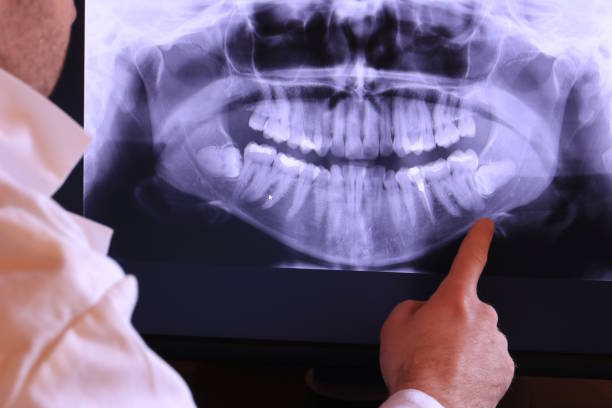 Best Emergency Dentist for Knocked-Out Tooth in Seneca, MO